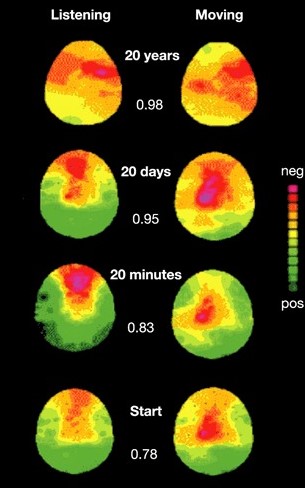 The Musician's Brain as a Model of Neuroplasticity study Münte, Altenmüller and Jäncke-2002